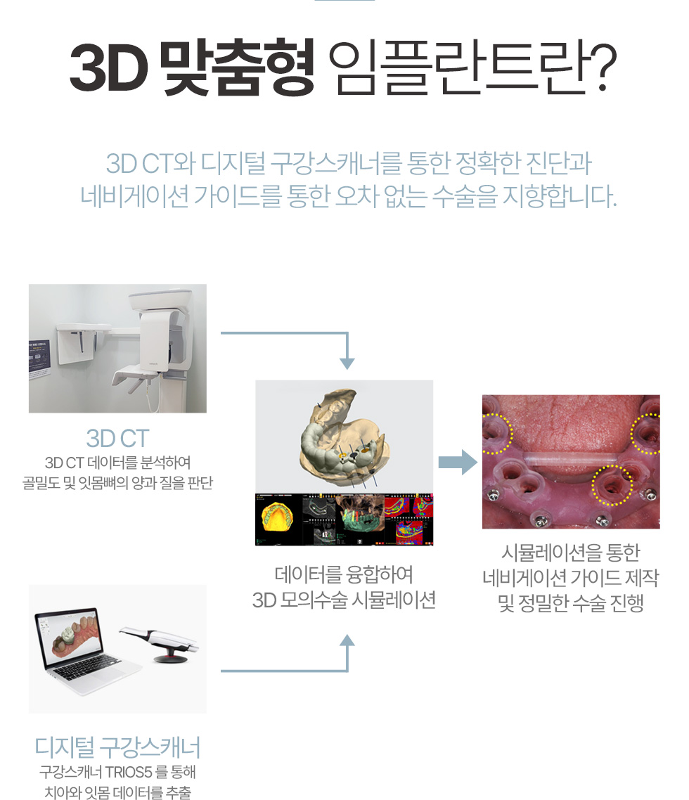 임플란트 클리닉