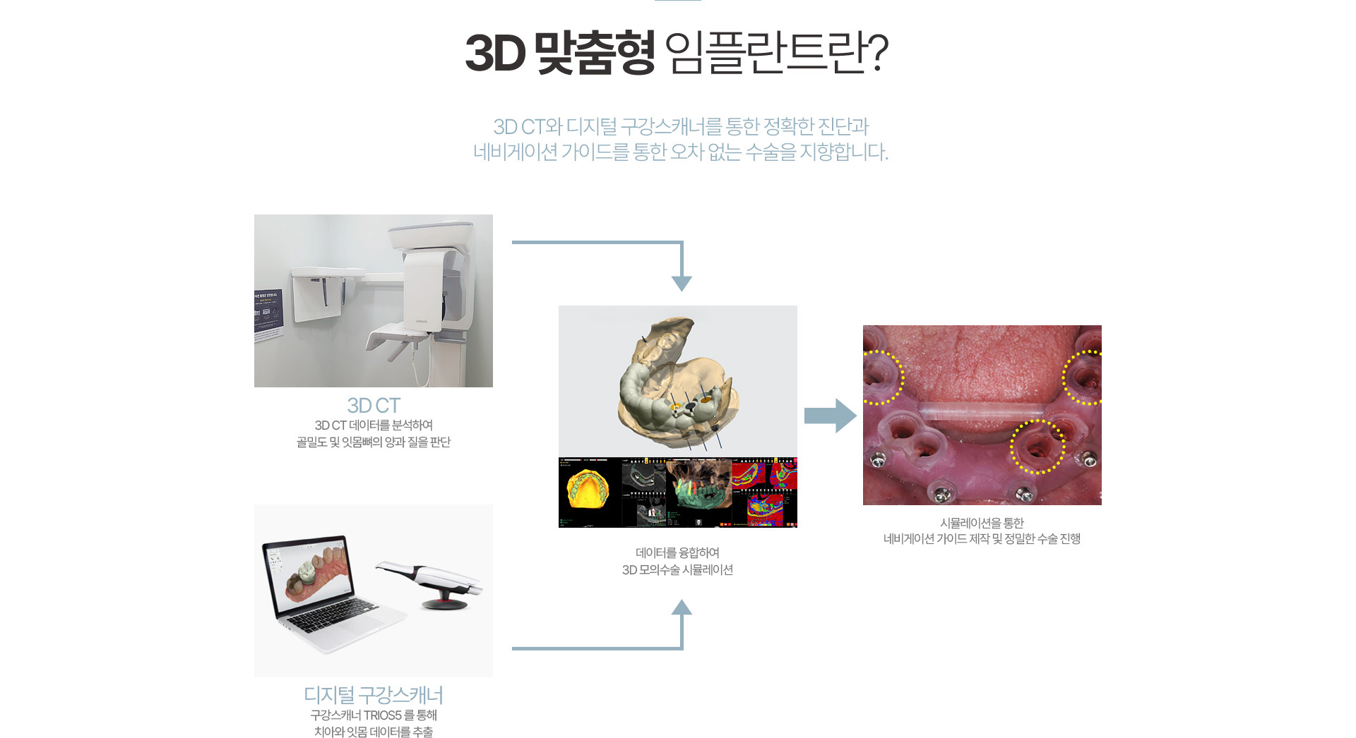 임플란트 클리닉